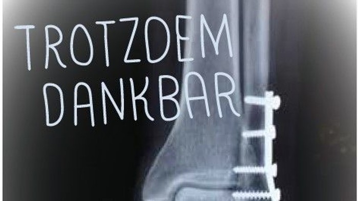 X-Röntgenbild eines gebrochenen Fußes mit Metallplatte und Schrauben, beschriftet mit 